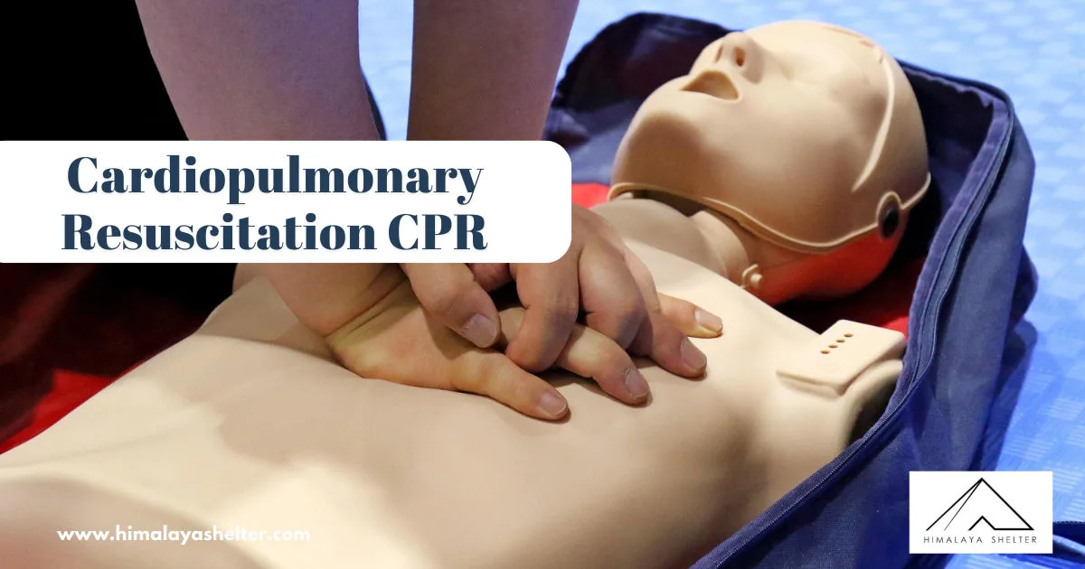 Cardiopulmonary Resuscitation CPR: A life saving technique